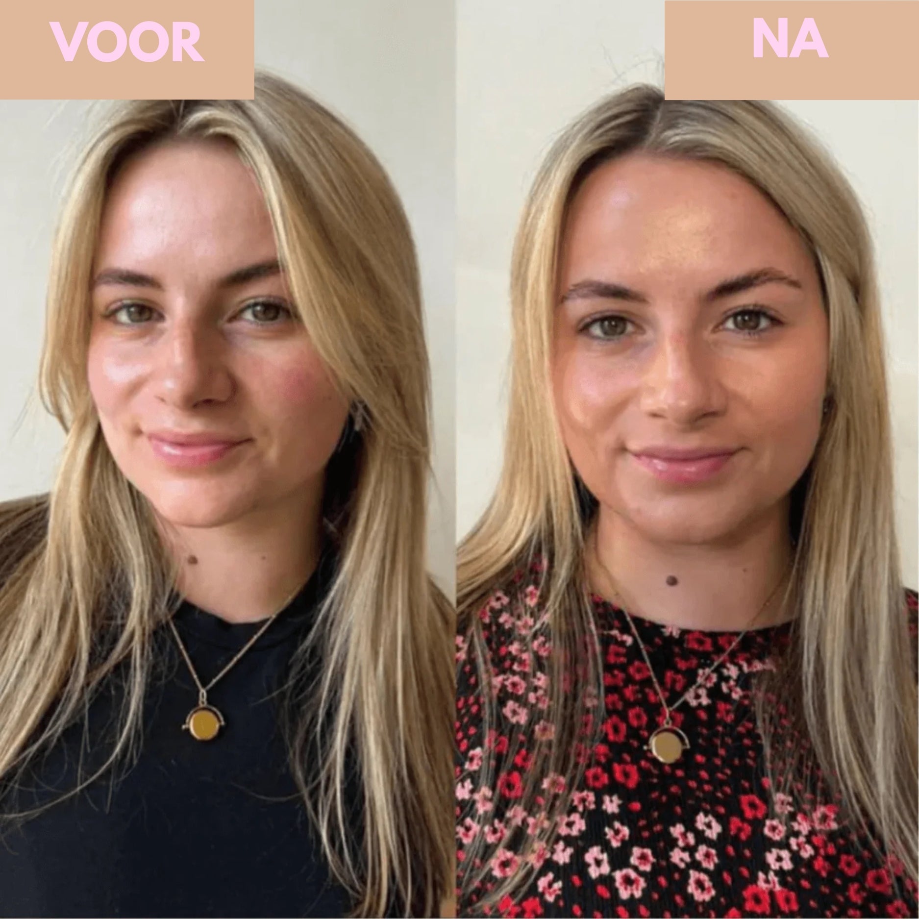 Milano Drop - De Italiaanse Glow, Zonder Zon