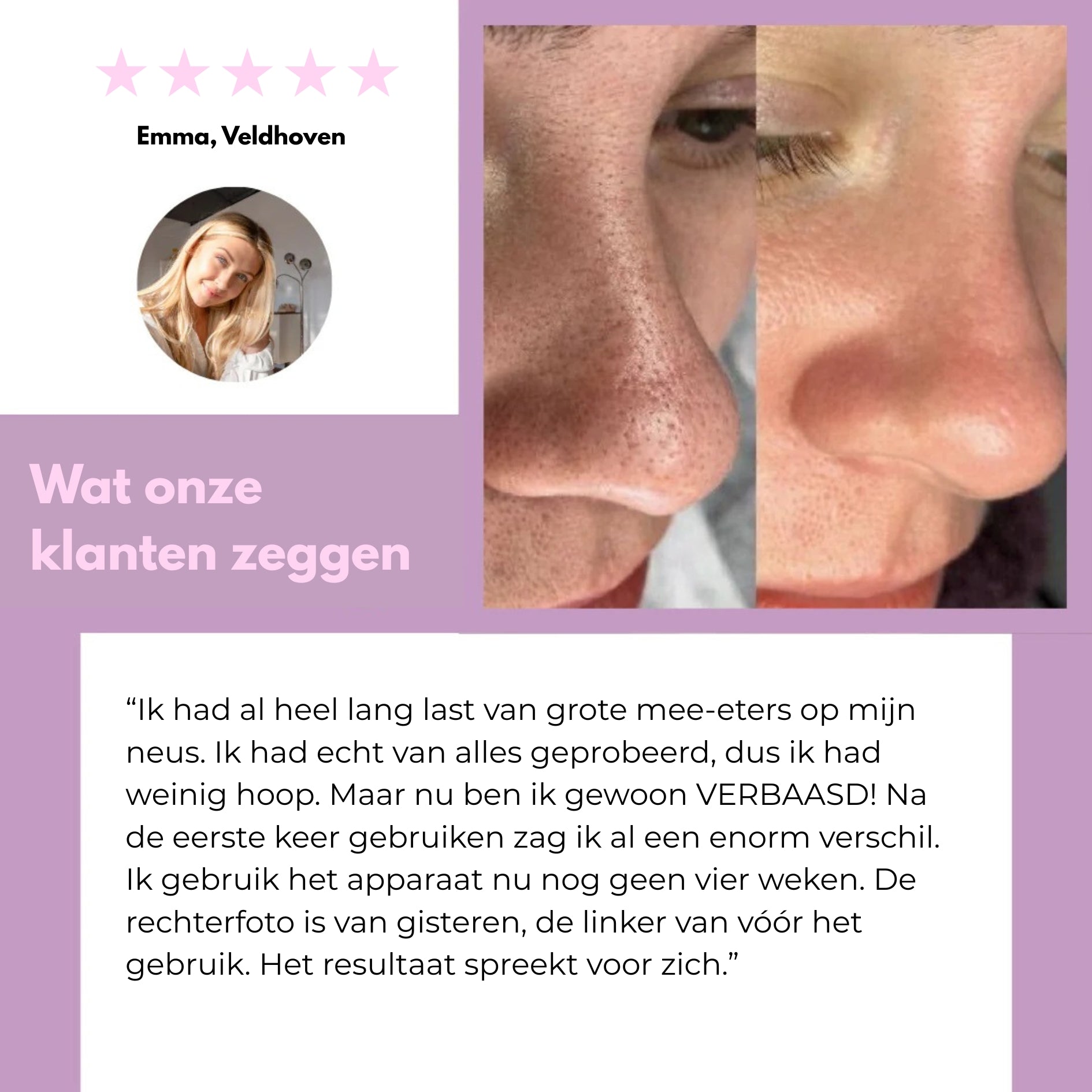 Sideo HydraLab – Intensieve Reiniging voor een Perfect Schone Huid