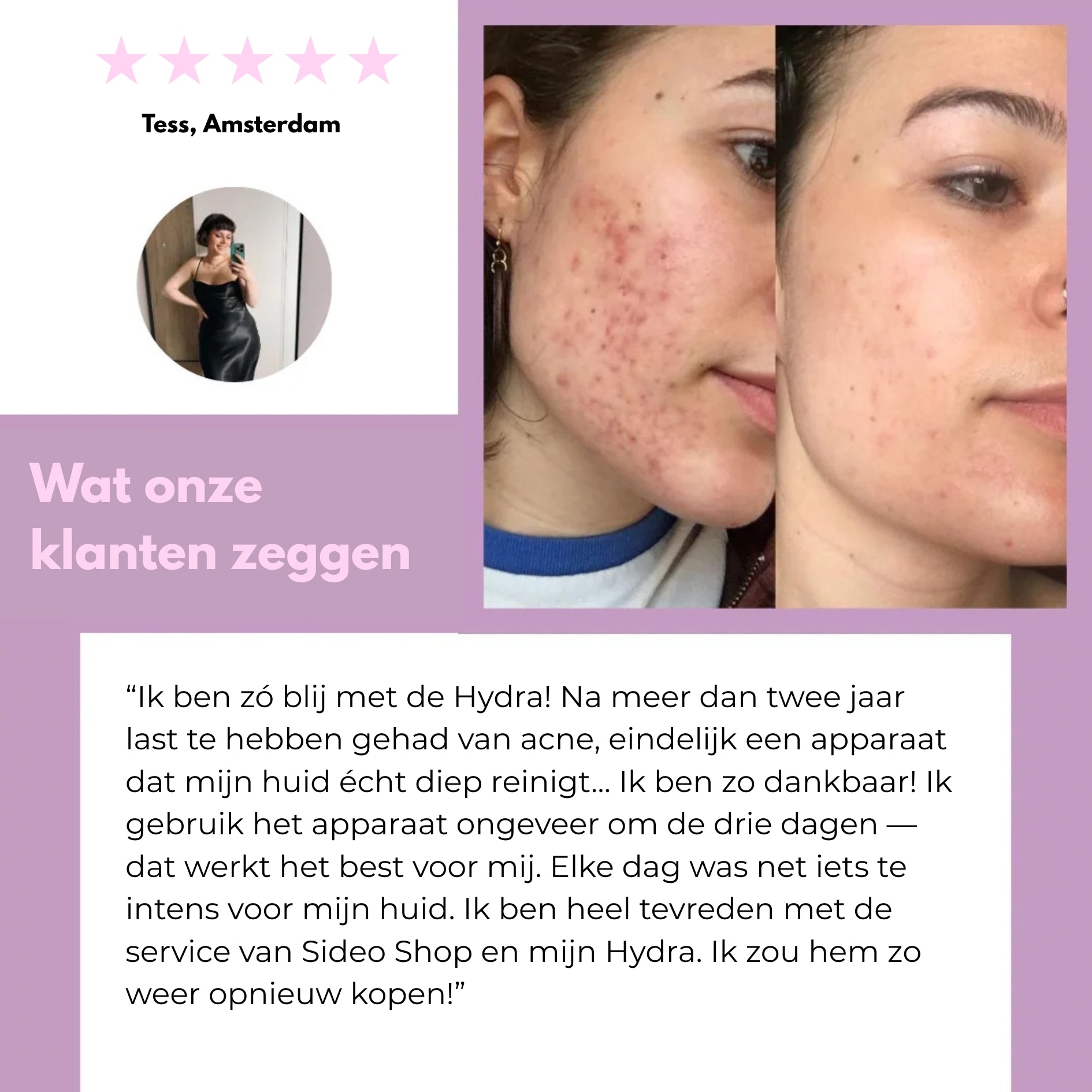 Sideo HydraLab – Intensieve Reiniging voor een Perfect Schone Huid