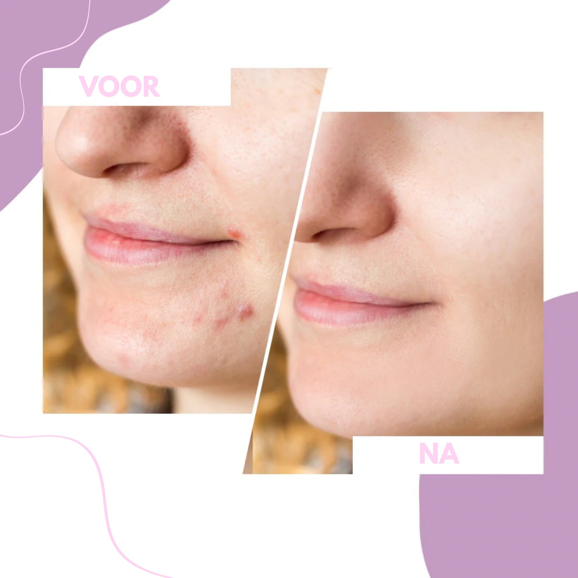 Sideo HydraLab – Intensieve Reiniging voor een Perfect Schone Huid