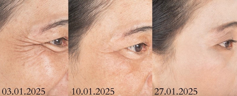 De Virale Instant Anti-Rimpelcrème