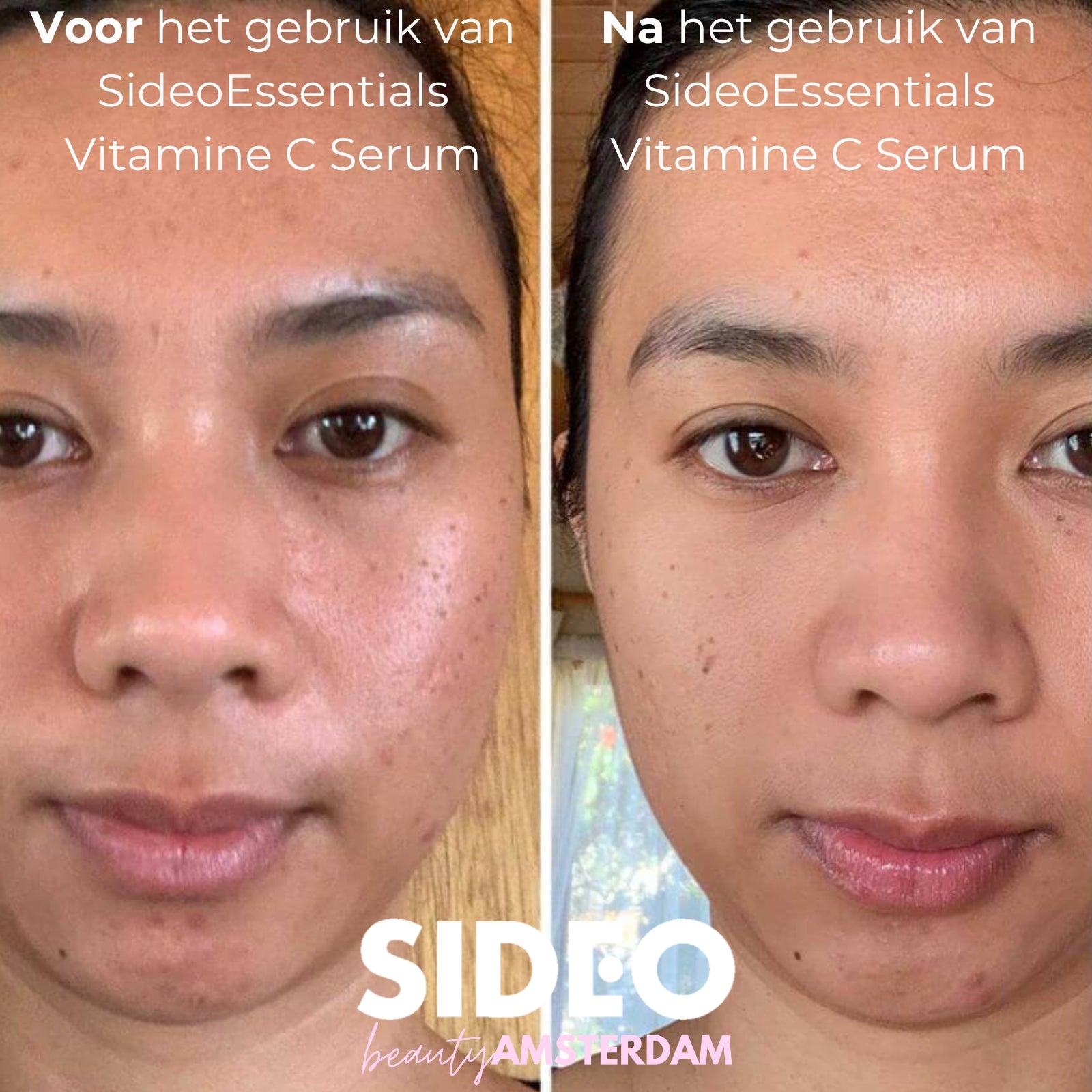 Het Virale SideoEssentials™ Vitamine C Serum