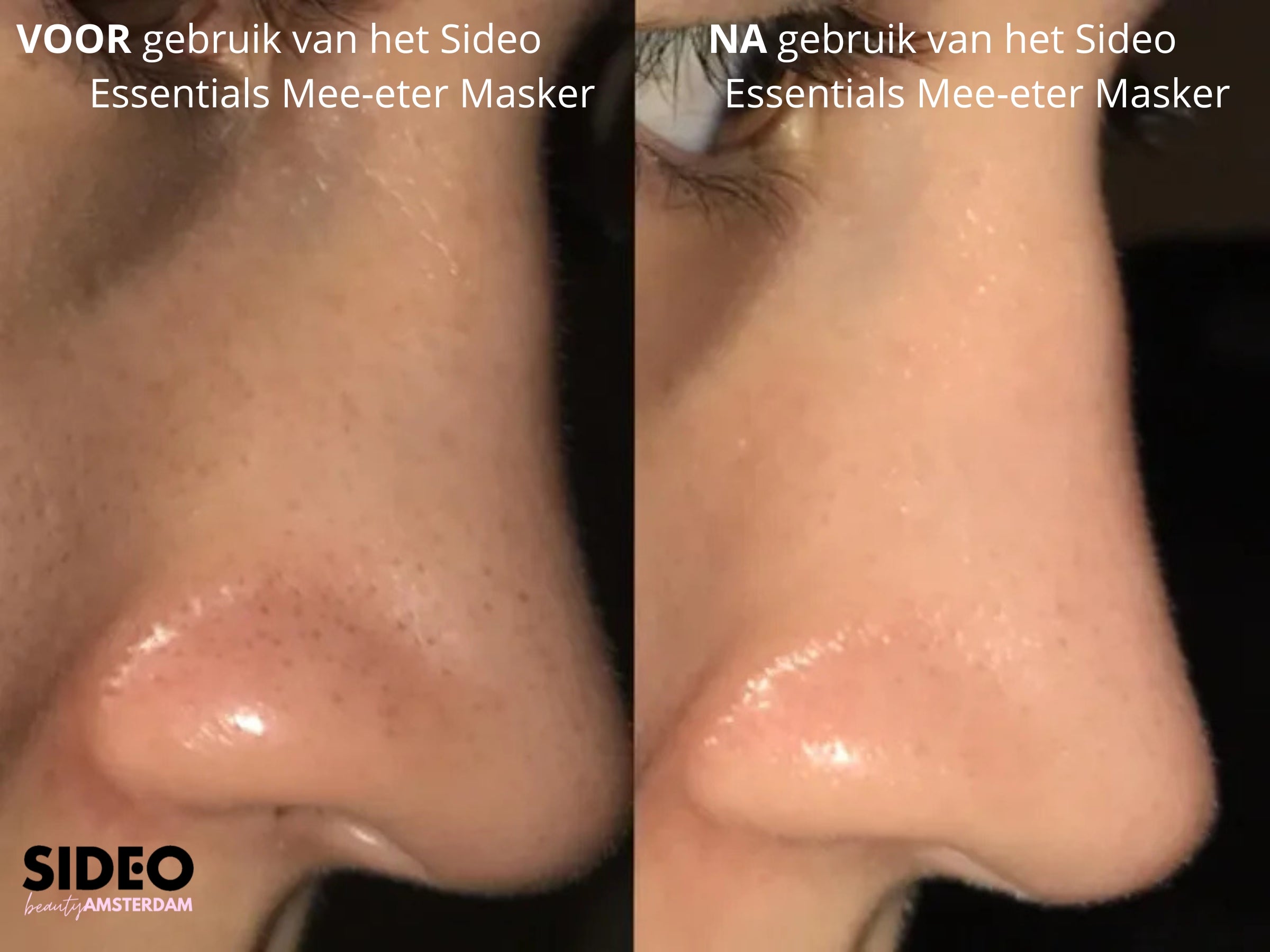 Mee-etermasker - Diepe Reiniging voor een Zichtbaar Gladde Huid