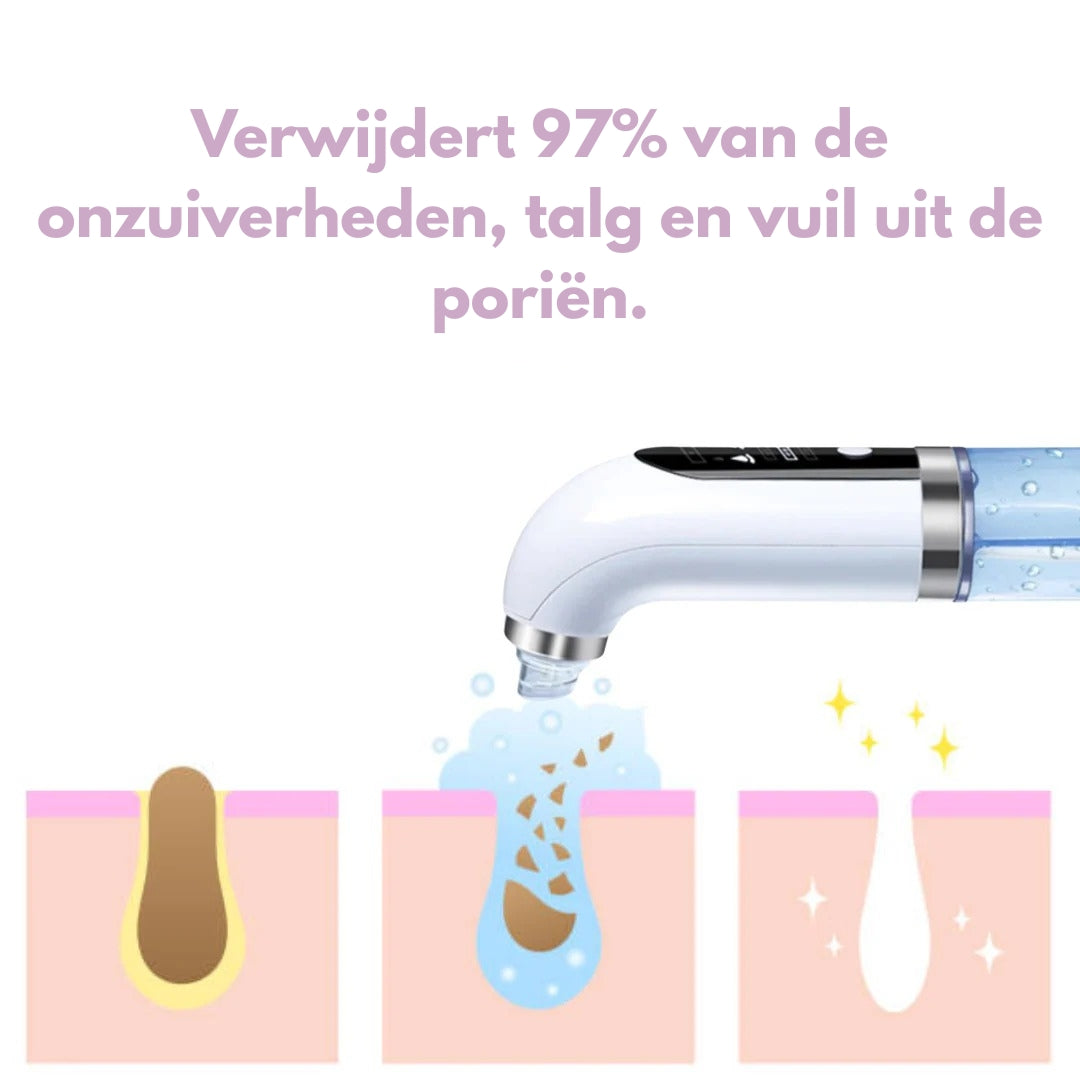 Sideo HydraLab – Intensieve Reiniging voor een Perfect Schone Huid