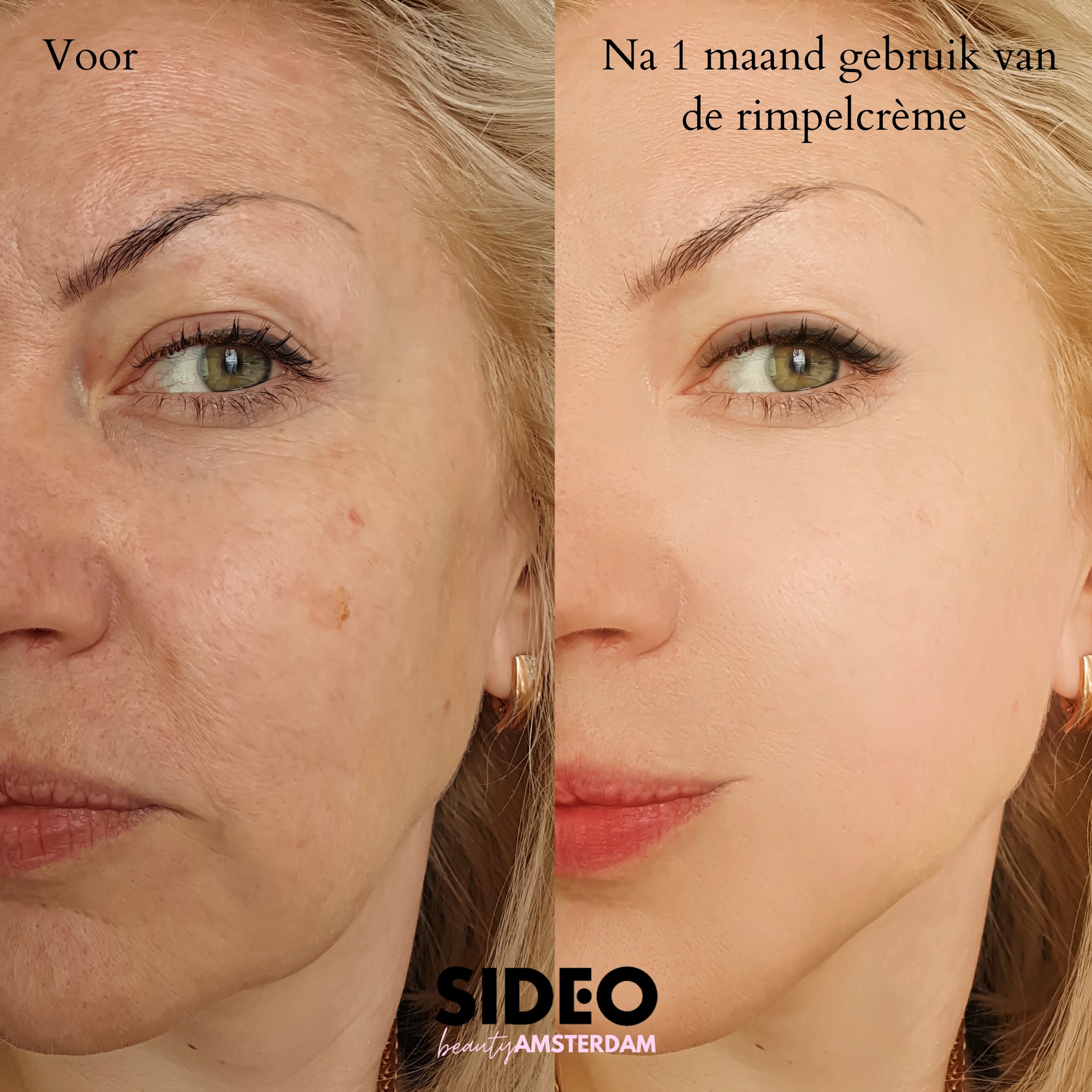 De Virale Instant Anti-Rimpelcrème