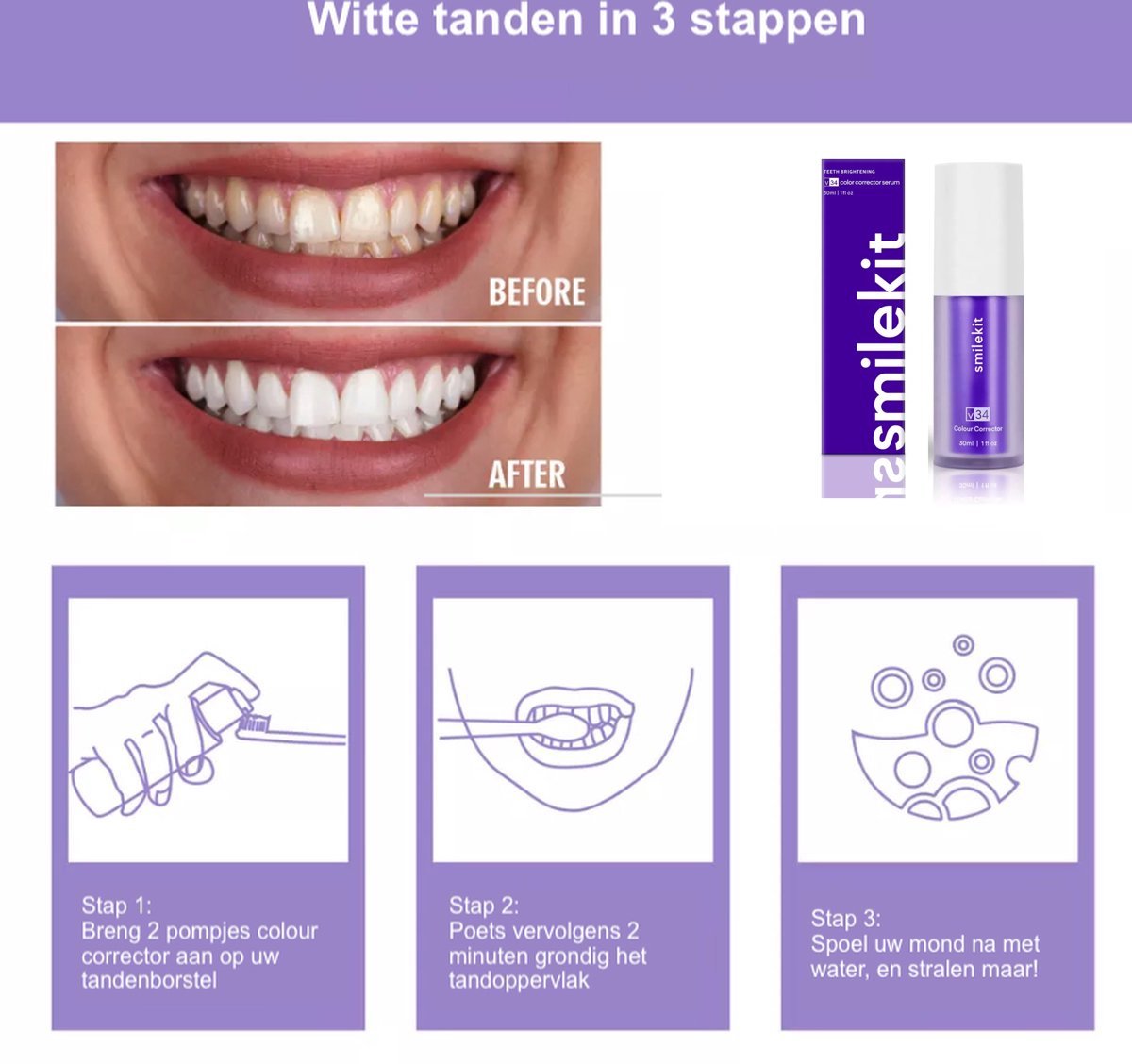 V34 Tandenserum