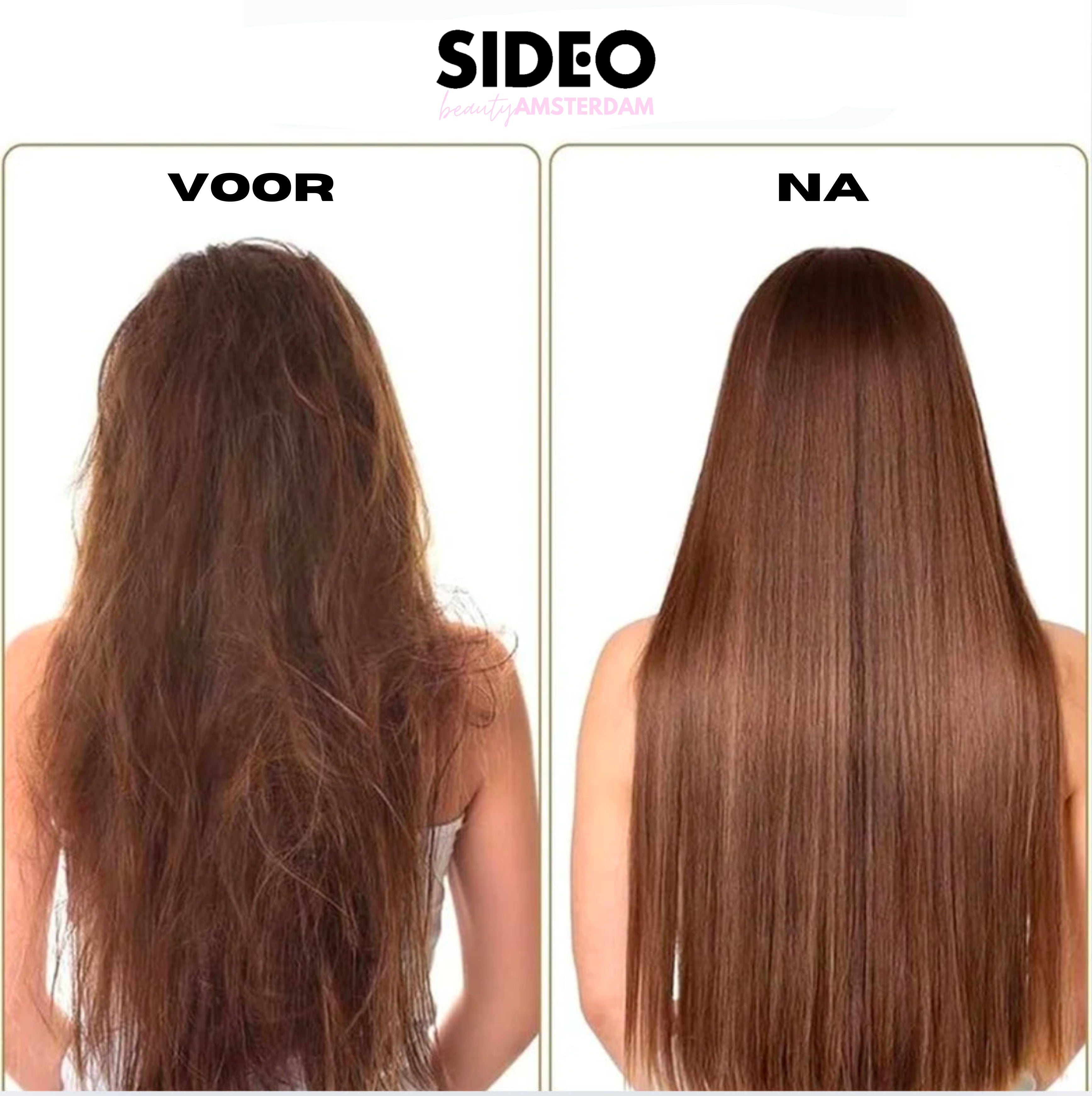 De Virale SideoEssentials™ Haargroeiolie